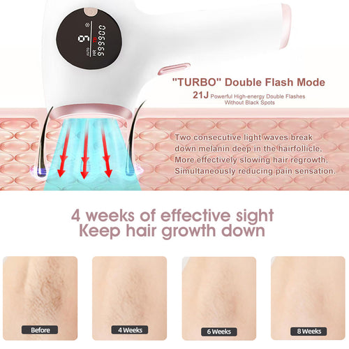 Epiglow- épilateur laser